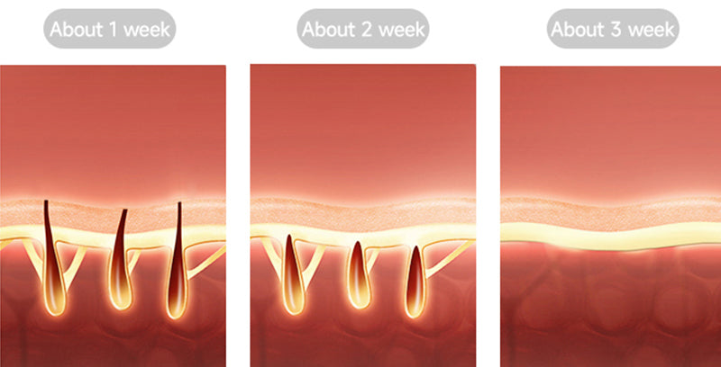 7 benefits of using IPL at home