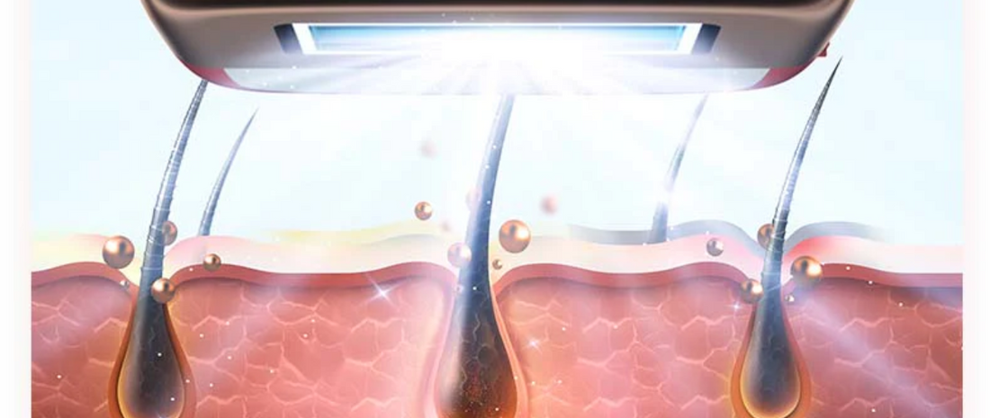 Step by step: how to use IPL device at home?