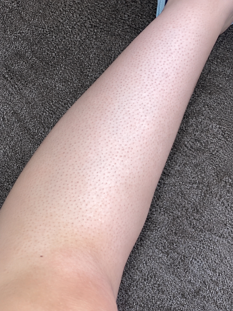 Legs & Arms