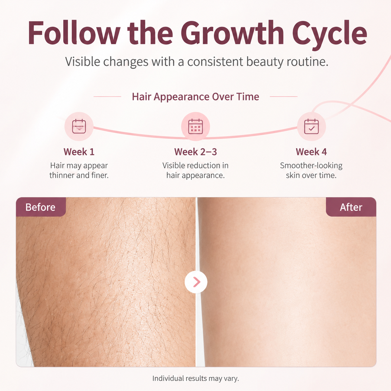 MLAY T4  Home Use IPL Hair Removal Device with Ice-Cooling System