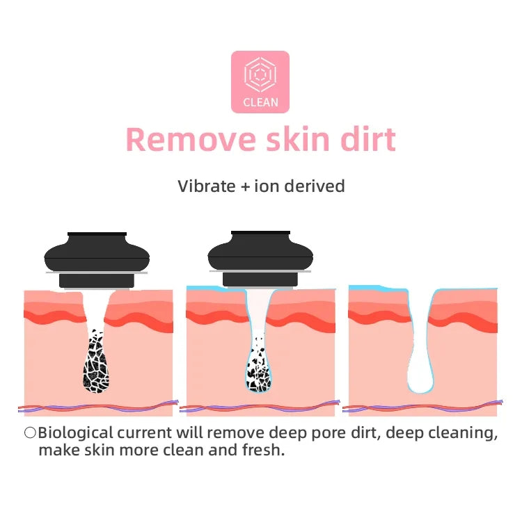 MLAY S3 Handheld RF Beauty Device - Wrinkle Remover, Face Lift & Skin Rejuvenation