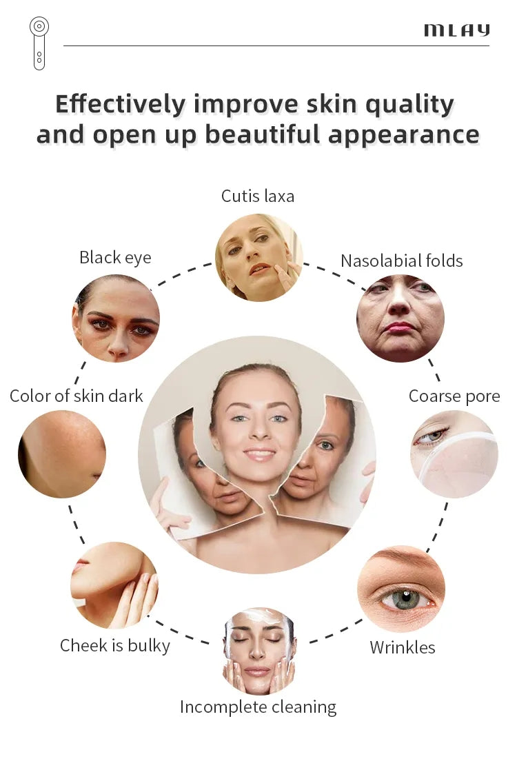 MLAY S3 Handheld RF Beauty Device - Wrinkle Remover, Face Lift & Skin Rejuvenation